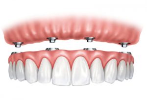 Teeth Photo