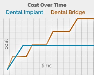 Cost Over Time Graph for Dental Implants and Dental Bridges
