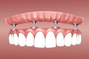 Teeth Photo