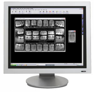 Monitor